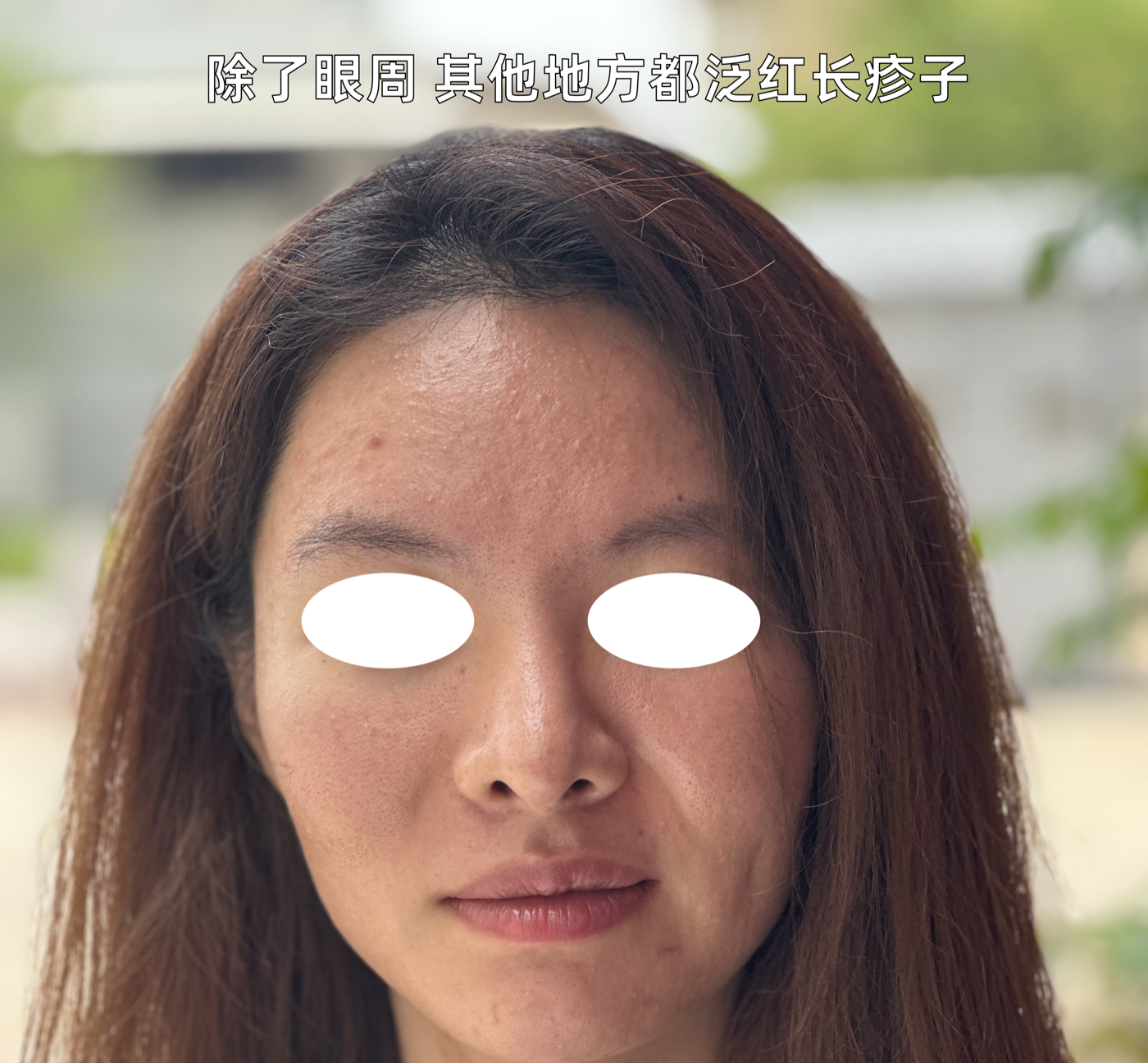 肌肤泛红记录图
